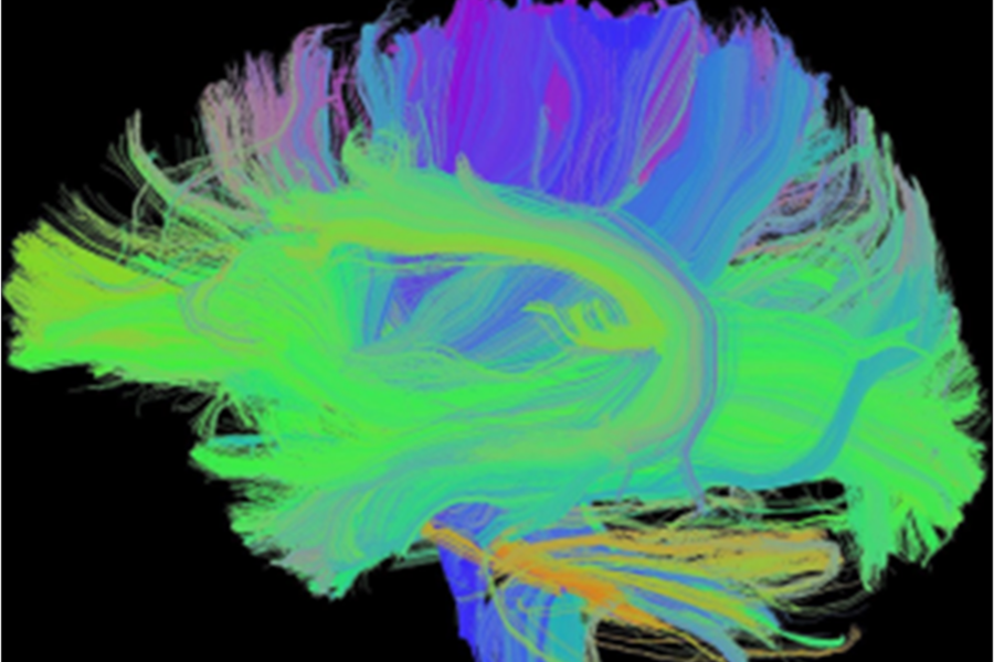 Brain Tractography